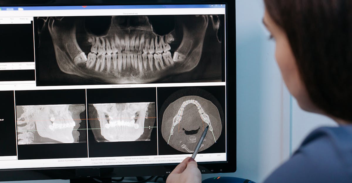 découvrez les méthodes de diagnostic structurel pour évaluer, analyser et garantir la sécurité des bâtiments et infrastructures. solutions fiables pour la maintenance et la prévention des risques.